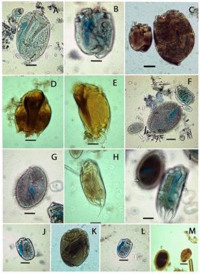 Rumen Ciliated Protozoa of the Free-Living European Bison (Bison bonasus, Linnaeus)